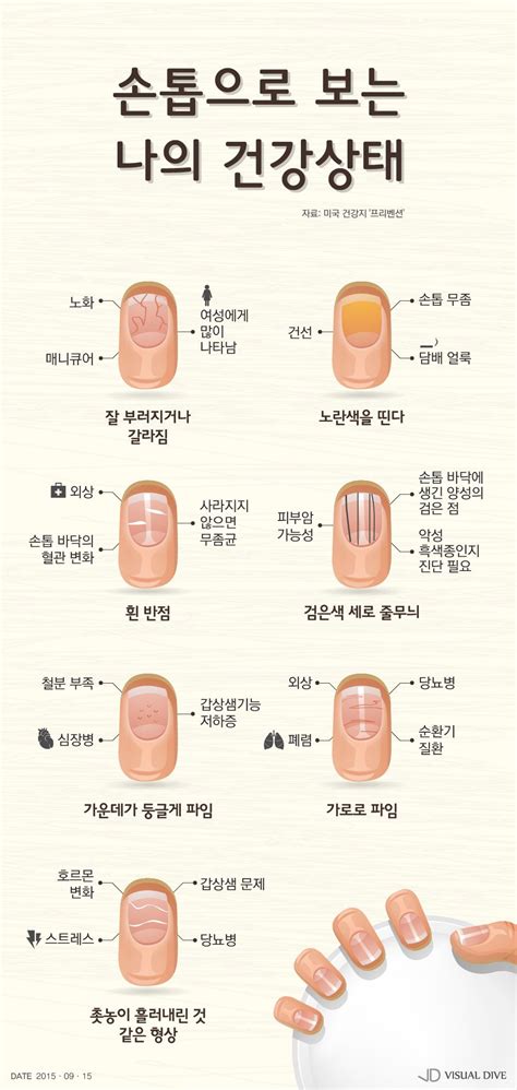 손톱으로 보는 나의 건강상태는 인포그래픽 Nail Infographic ⓒ 비주얼다이브 무단 복사·전재·재배포 금지