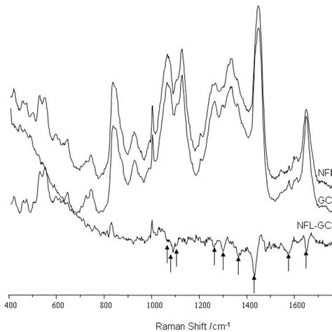 Raman Spectra Of The Nerve Fiber Layer And Ganglion Cell Layer The