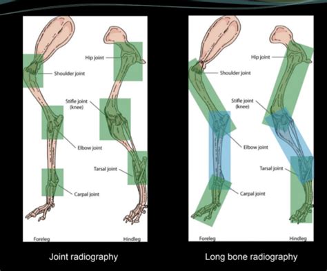 Radiology 1 MSK Flashcards Quizlet