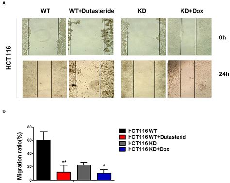 Frontiers Steroid Reductase Type I Induces Cell Viability And