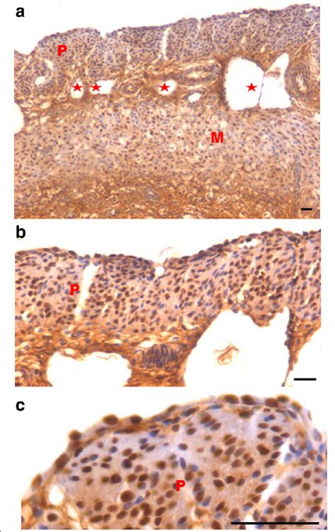 Immuno Localization Of Proliferation Marker Pcna After Treatment With