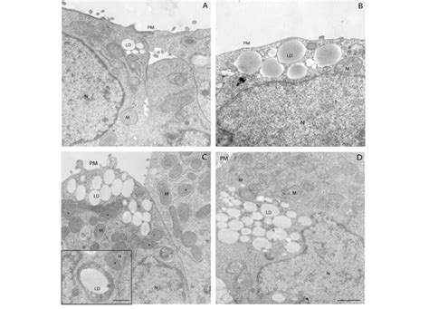 Representative Tem Images Of Lds In Nm Ultrathin Sections Of The