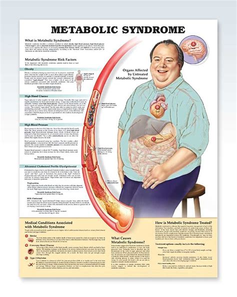 Metabolic Syndrome Exam Room Anatomy Poster Clinicalposters