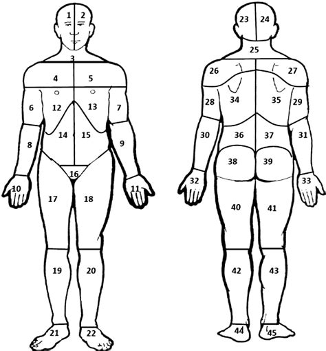 Pain Diagram Of Body