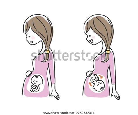 Illustration Breech Baby Normal Baby Stock Vector (Royalty Free ...