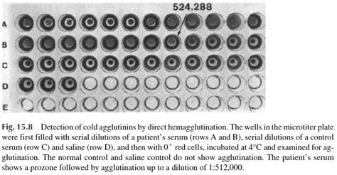 Assay Methods Based On Agglutination Immunoserology