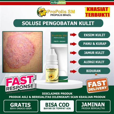 Jual Obat Gatal Kulit Panu Scabies Jamur Kulit Eksim Kering Dan Basah