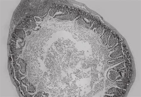 Histological Appearance Of The I R Group Villous Epithelial