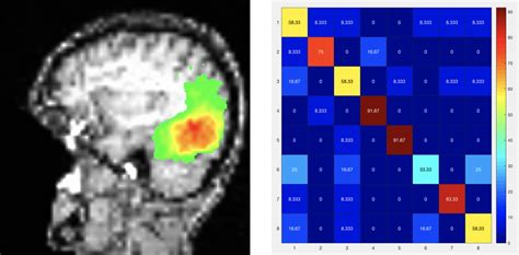 Introduction To Multi Voxel Pattern Analysis With The Decoding Toolbox