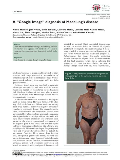 (PDF) A “Google Image” diagnosis of Madelung’s disease