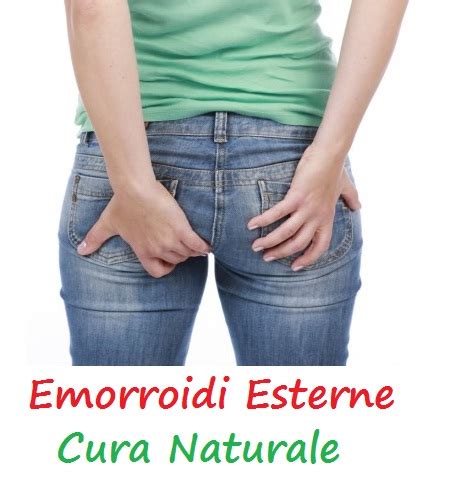 Emorroidi Esterne Cura Naturale Come Curare Le Emorroidi Esterne Mai