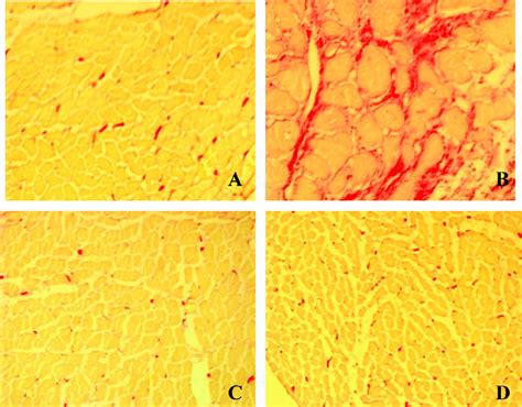 Effects Of Houttuynin On Cardiac Collagen Accumulation In The