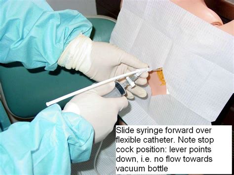 Thoracentesis Procedure