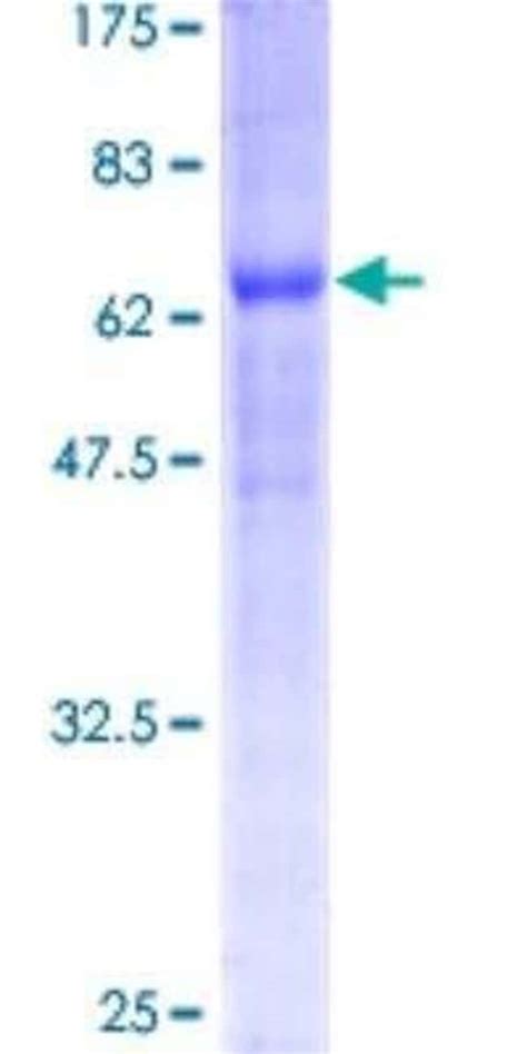 Novus Biologicals Recombinant Human BNIP2 GST N Term Protein 25 μg