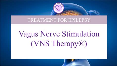 Vagus Nerve Stimulation The Defeating Epilepsy Foundation