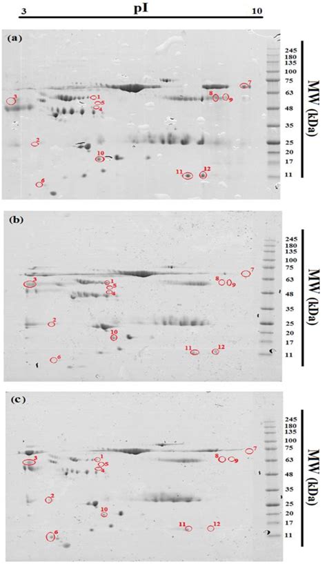 Figure 1 From Following Up Of Surgical Treated Human Liver Cystic Echinococcosis A Proteomics