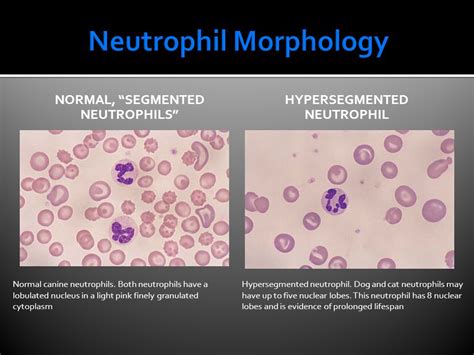 Leukocytes Wbc Morphology Clinical Pathology Vtht Ppt Video Online Download