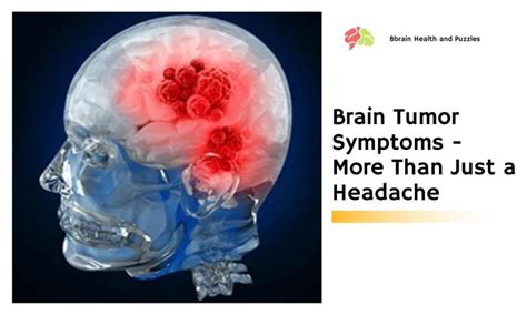 Brain Tumor Symptoms - More Than Just a Headache | Brain Health and Puzzles