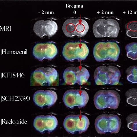 (PDF) Adenosine A2A receptor imaging with [11C]KF18446 PET in the rat ...