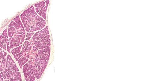 Strategies for Addressing Sialorrhea - Dimensions Students