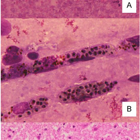 Light microscopy of brain tissue obtained from children dying from... | Download Scientific Diagram