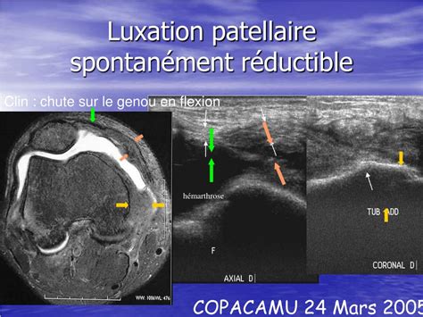 PPT Intérêt de léchographie pour le médecin urgentiste dans les