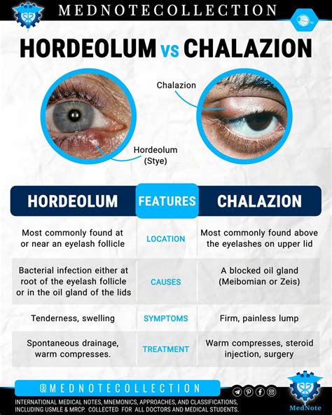 HORDEOLUM vs. CHALAZION | Anatomia y fisiologia humana, Fisiología ...