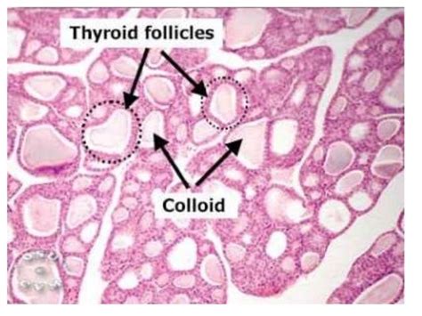 Thyroid gland