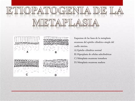 Metaplasia Final Ppt