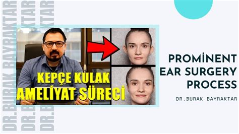 Kep E Kulak Amel Yat S Rec Dr Burak Bayraktar Youtube