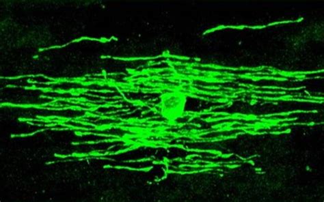 Oligodendrocyte dynamics dictate cognitive performance outcomes of ...