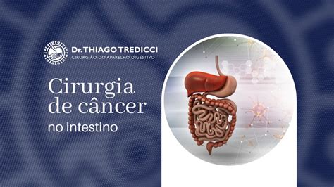 Cirurgia de câncer no intestino o que é e como é feita