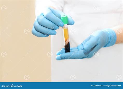 Medical Test Tube With Blood Plasma In His Hands For Prp Therapy Stock