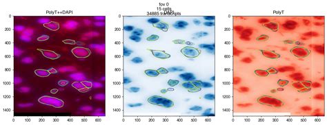 5. Cellpose Segmentation — MERFISHing