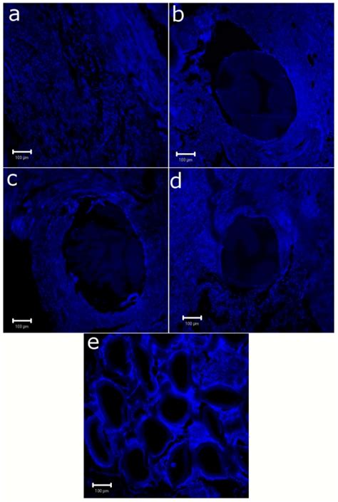 Confocal Laser Micrographs Of Immunohistochemical Stained Tissue Of A