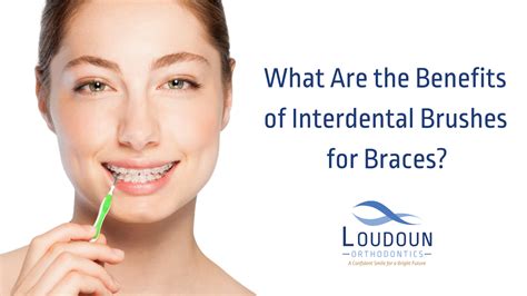 What are the Benefits of Interdental Brushes for Braces?