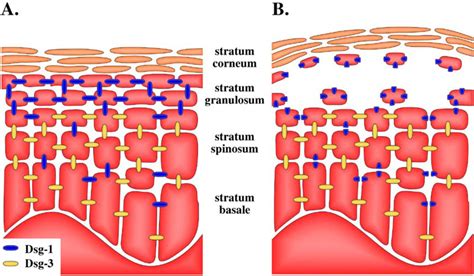 Toxins Free Full Text Exfoliative Toxins Of Staphylococcus Aureus