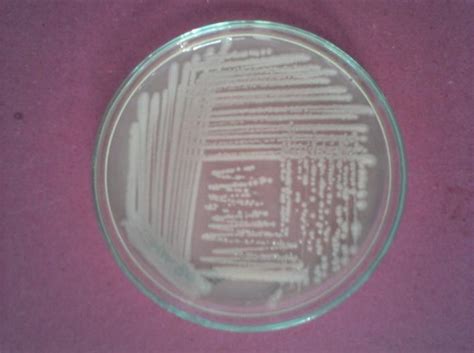 Isolated Colony Of Pseudomonas Isolate Kk On Nutrient Agar Plate