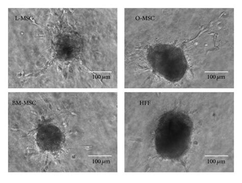 In Vitro Angiogenesis Of Msc Conditioned Medium D Collagen Embedded