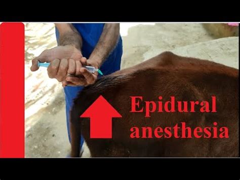 Epidural Anesthesia In Calf Anestesia Epidural En Bovinos