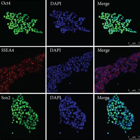 Characterization Of HiPSCs And HiPSC CMs A Immunostaining Of HiPSCs