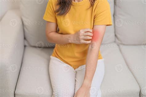 Woman Itching And Scratching Itchy Arm Sensitive Skin Allergic