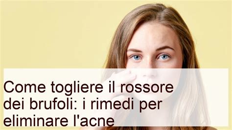 Come Togliere Il Rossore Dei Brufoli I Rimedi Per Eliminare L Acne