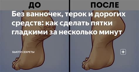 Без ванночек, терок и дорогих средств: как сделать пятки гладкими за ...