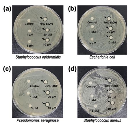 Antibacterial Activity Determined By Paper Disc Method A