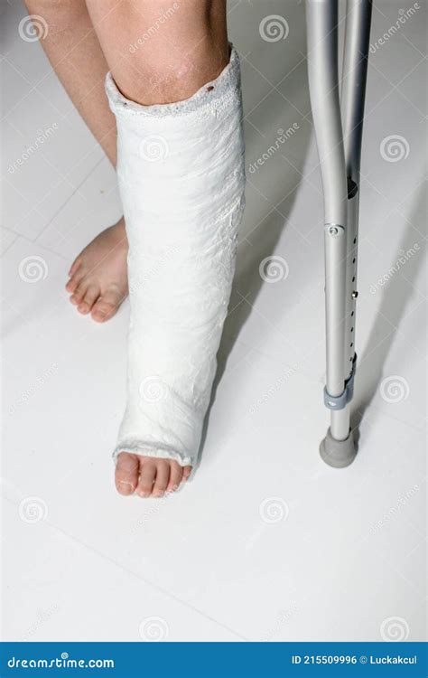 Detail Left Leg Or In White Plaster Placed And Crutch Stock Photo