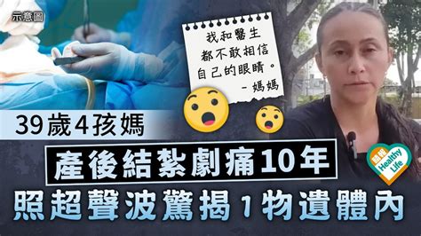 醫療事故｜哥倫比亞39歲4孩媽 產後結紮劇痛10年 照超聲波驚揭1物遺體內 晴報 健康 女性疾病 D230428