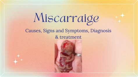 Miscarriage