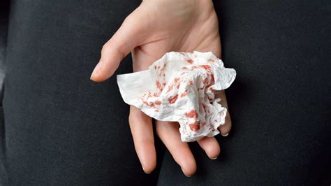 Estou Cuspindo Sangue O Que Pode Ser - Cuspir sangue - Principais causas, sintomas e o que fazer