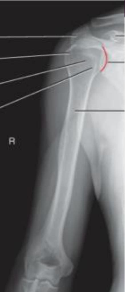 Humerus x ray Diagram | Quizlet